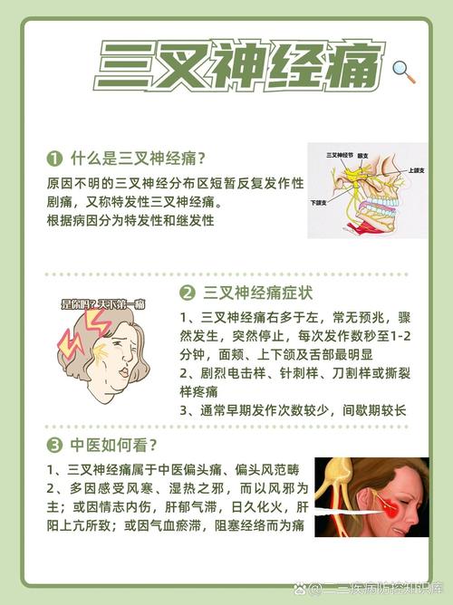 民间三叉神经痛偏方大全-滨州三叉神经痛医院哪个好(图1)